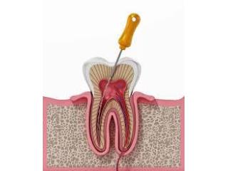 Reliable Dental Treatment and Consultation in Malad East