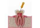 Reliable Dental Treatment and Consultation in Malad East