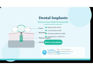 Affordable Dental Implant in Carlisle PA | Carlisle Dental Care