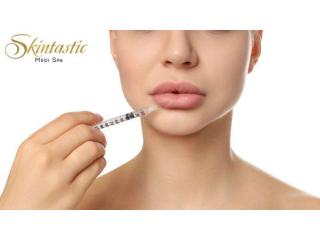 Premium Lip Fillers Riverside for Smooth Lip Volume