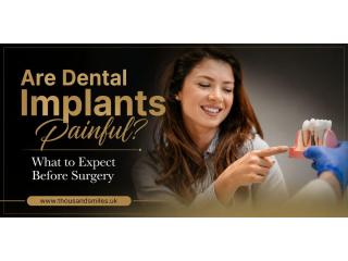 Are Dental Implants Painful? What to Expect Before Surgery