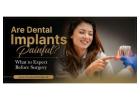 Are Dental Implants Painful? What to Expect Before Surgery