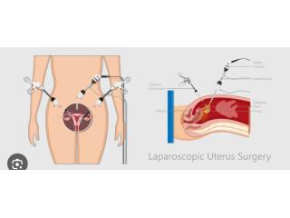Hernia Surgery Near You