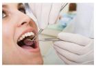Root Canal Treatment Mount Roskill, Auckland 