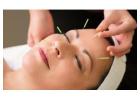Facial Acupuncture for Youthful and Glowing Skin 