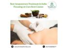Best Acupuncture Treatment in India Focusing on Cure Root Causes
