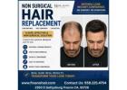 Non Surgical Hair Replacement For Men in Fresno, CA.
