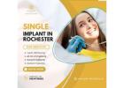 Expert Single Dental Implant in Rochester – GM Dental