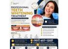 Teeth Whitening Treatment in Perris | Dr. Tejas Modi