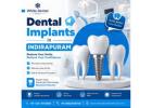 Dental Implants in Indirapuram for Permanent Tooth Replacement