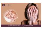Best Vitiligo Specialist in Bangalore for Advanced Skin Care - Dermaqure Skin and Cosmetology Clinic