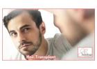 Best Clinic For Hair Transplant in Gurgaon - SB Trichology