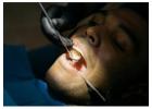 Teeth Removal and Dental Implants – Restore Your Healthy Smile