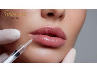 Achieve Gorgeous Lips with Lip Fillers Riverside