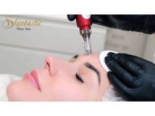 Best Potenza Microneedling Near Me in Riverside
