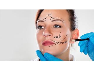 Facelift Surgery in Delhi - Dr Rajat Gupta