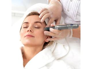 Microneedling Treatment Houston for Radiant Skin