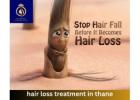 Advanced Hair Loss Treatment in Thane | DNA Royal Clinic.