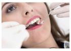 Gum Disease Treatment Auckland