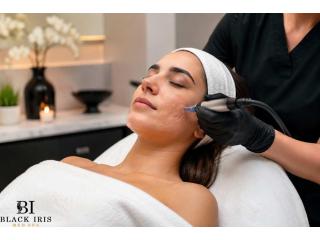 Acne Scarring Treatment Plano | Advanced Acne Scar Removal | Black Iris Med Spa