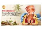 How Constipation Increases the Risk of Piles Disease