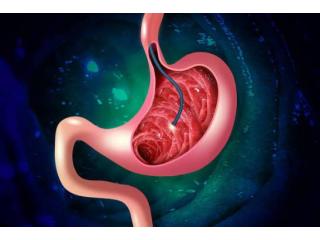 Advanced Endoscopy by Best Endoscopist Ludhiana