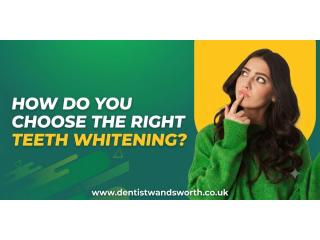 How Do You Choose the Right Teeth Whitening for Your Smile?