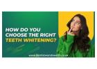 How Do You Choose the Right Teeth Whitening for Your Smile?