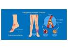 Peripheral Arterial Disease Treatment 