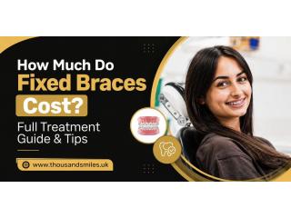 How Much Do Fixed Braces Cost? Full Treatment Guide & Tips