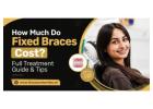 How Much Do Fixed Braces Cost? Full Treatment Guide & Tips