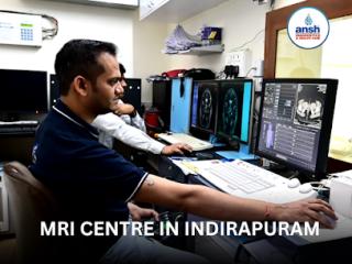 MRI Angiography Brain and Neck Vessels | Book MRI Scan