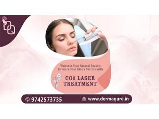 Get Professional CO2 Laser Treatment in Bangalore Today -Dermaqure Skin and Cosmetology Clinic