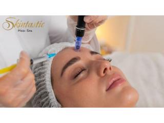 Potenza Microneedling Near Me in Riverside for Smoother Skin