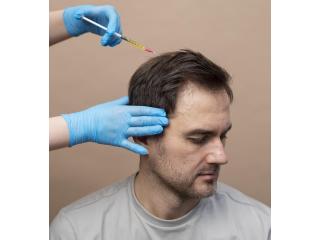 Hair Transplant in Kolkata Advanced Permanent Hair Restoration