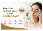 What Is the Fastest Way to Heal a Swollen Eye?