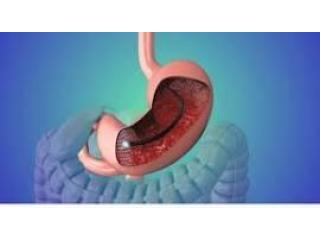 Therapeutic Endoscopy Specialist in Punjab – Dr. Nitin Behl