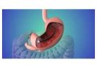 Therapeutic Endoscopy Specialist in Punjab – Dr. Nitin Behl