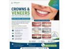 Top-Rated Crowns and Veneers Clinic Ahmedabad