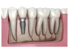 Welcome to Medora Dental Care