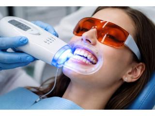 Teeth Whitening in Abbotsford | Professional Smile Brightening