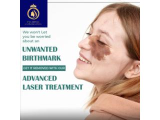 Advanced Laser Birthmark Removal in Thane | DNA Royal Skin Clinic.
