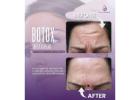 Allodermis Skin Clinic | Advanced Botox Treatment in Jajpur