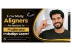 How Many Aligners Are Needed for Moderate Invisalign Cases?
