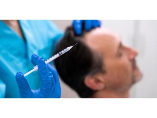 Premium Non-Surgical Hair Replacement Systems in London