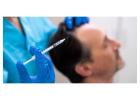 Premium Non-Surgical Hair Replacement Systems in London