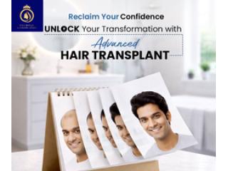 DNA Royal: No.1 Hair Transplant Clinic in Thane for Natural Results.