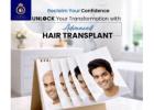 DNA Royal: No.1 Hair Transplant Clinic in Thane for Natural Results.