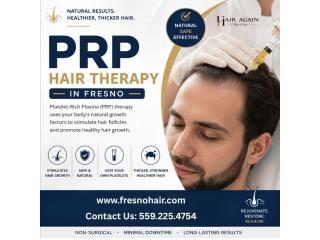 plasma rich platelet therapy for hair loss Fresno