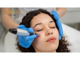 Potenza Microneedling Near Me in Riverside for Glowing Skin